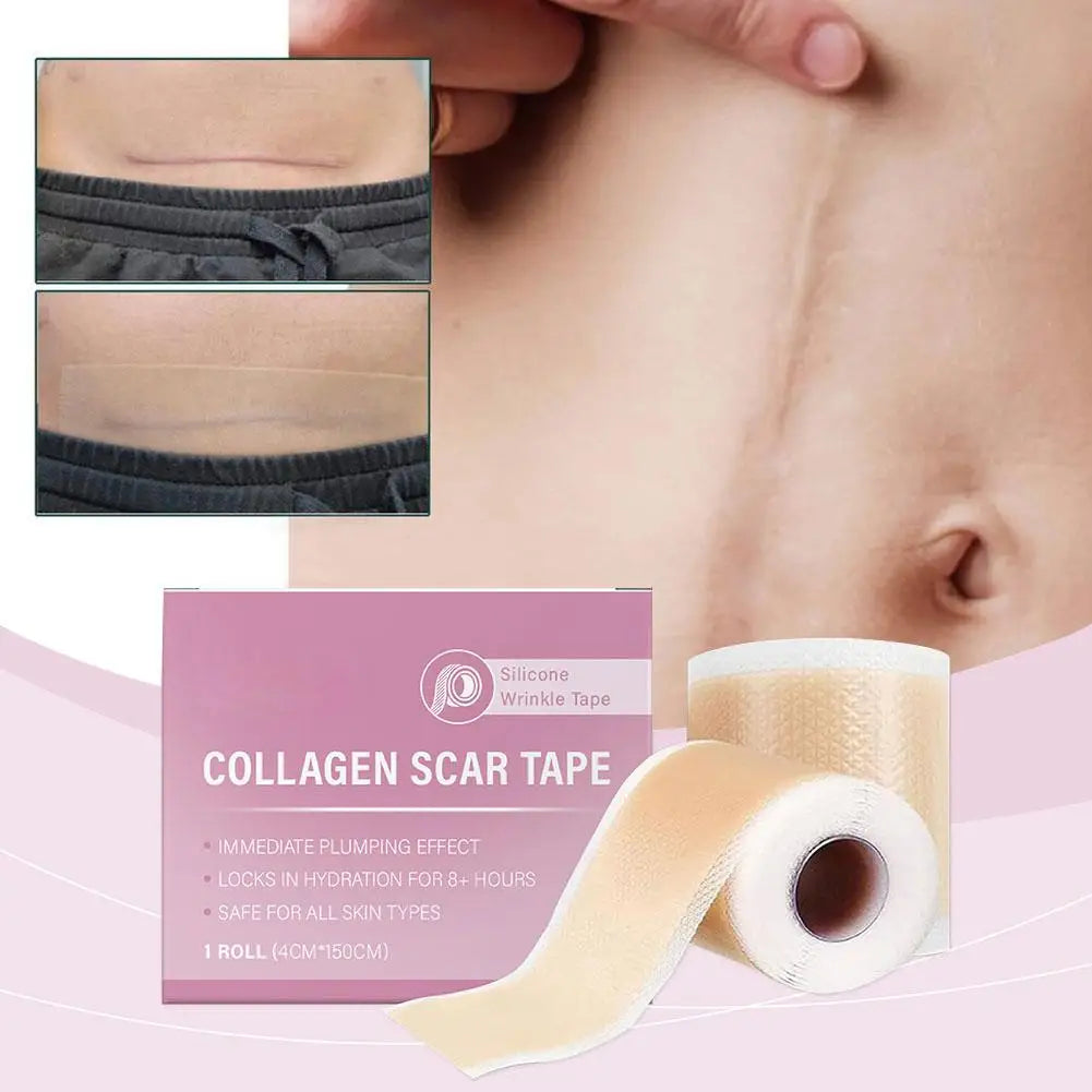 Silicone Scar Tape